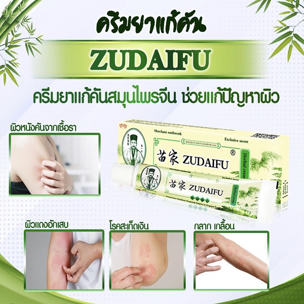 Zudaifu Cream ครีมสมุนไพรจีนทาบรรเทาโรคผิวหนัง